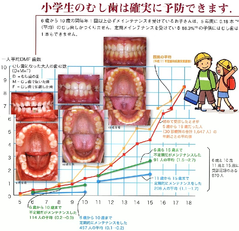 カリエスフリー 